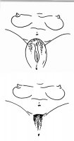 Anteprima:  Muschipumpe für besonders pralle Schamlippen