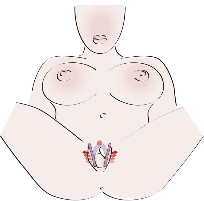 disegno di applicazione dello spargitore di labbra