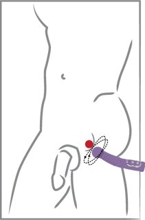 Prostate Twister per la mungitura della prostata Prostate Twister per la mungitura della prostata