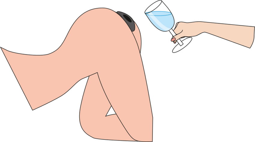 Anal# Applicazione della spina del tunnel